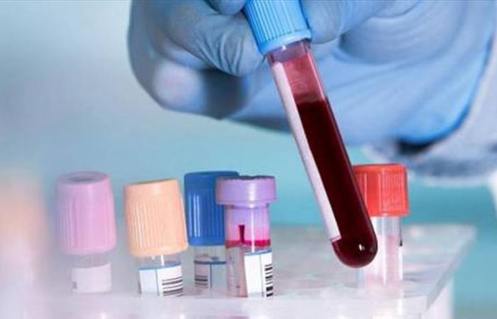 اختبار دم ثوري يكشف 50 نوعاً من السرطان!
