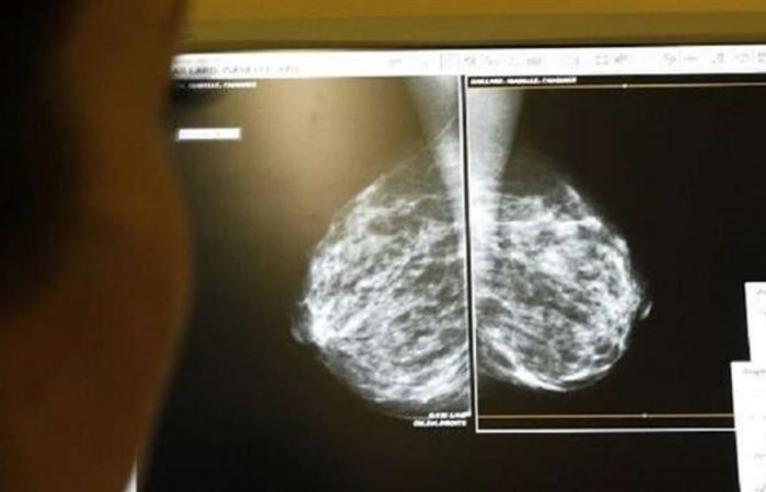 العلماء يحددون بروتيناً يسبب في نمو سرطان الثدي العدواني