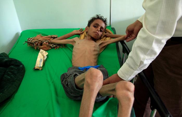 مطالبات بتحرك دولي عقب قصف الحوثي لمستشفى السرطان بتعز
