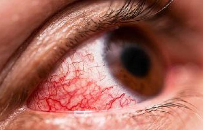 علماء أمريكان يتوصلون لطريقة جديدة لعلاج أمراض شبكية العين