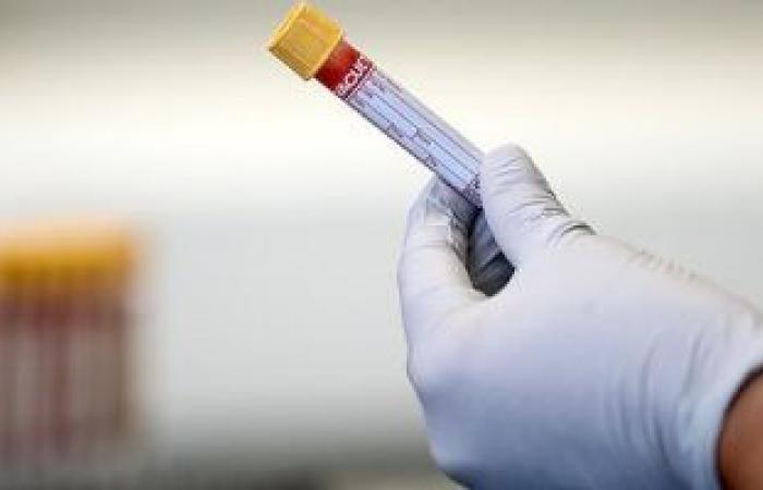 الاختبارات المتكررة والسريعة يمكن أن تشل فيروس كورونا فى غضون أسابيع