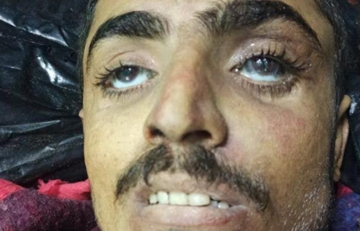 مصرع قيادي حوثي بارز وعشرات المسلحين غرب اليمن