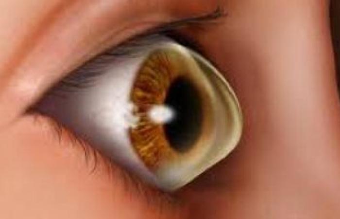 5 علامات فى العينين تخبرك بنقص فيتامين "د".. منهم الإحمرار وحساسية الضوء
