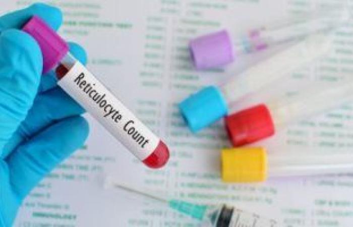ماهو تحليل MCH وما علاقته بفيروس كورونا والأمراض الأخرى؟