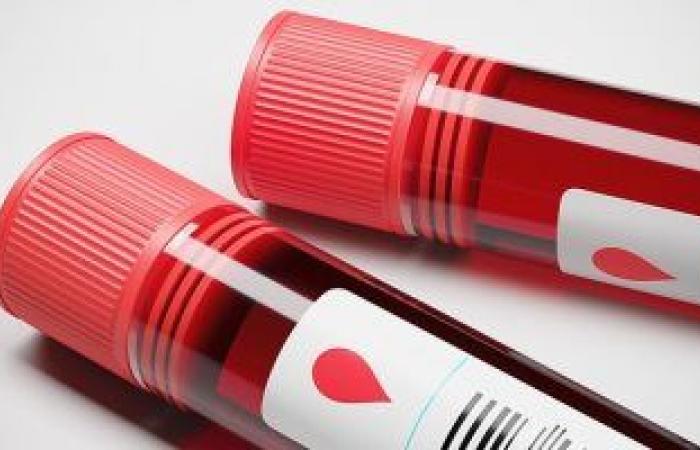ما هو اختبار الزلال في الدم؟.. تعرف على الأمراض التي يكشف عنها