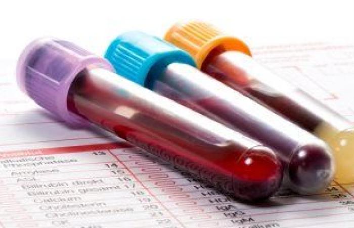 تعرف على تحليل الخلايا الليمفاوية ولماذا يطلبه طبيبك؟