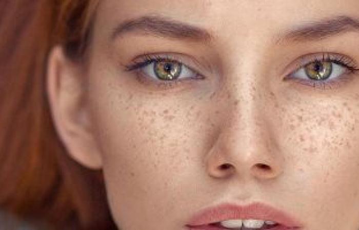4 علامات تظهر على وجهك تدل على نقص فيتامين "ب 12" فى جسمك