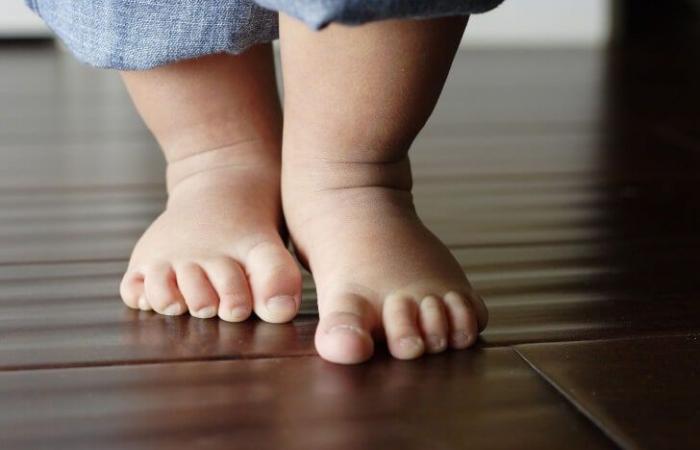 تقوس الساقين للأطفال أبرز أسباب نقص الكالسيوم وفيتامين د