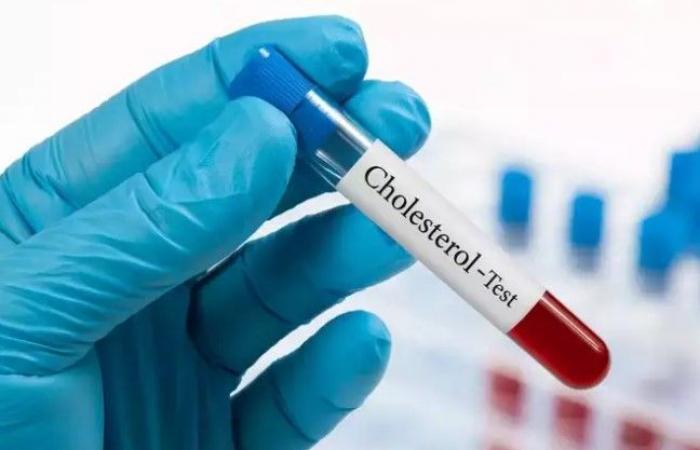 هل يجب تناول الأدوية وحدها لخفض الكوليسترول فى الدم؟