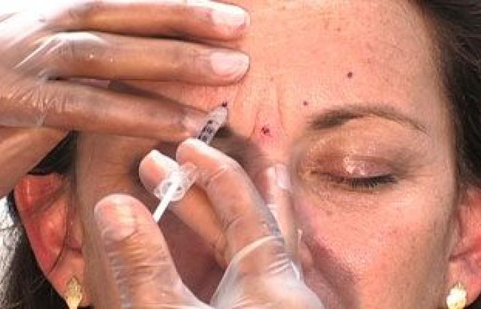 ما هو البوتوكس الوقائي وكيف يستخدم لمنع تجاعيد الوجه