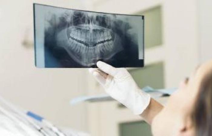 ما هي الأشعة البانورامية وما استخداماتها في كشف مشاكل الأسنان؟