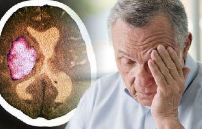 كيف يحميك الزبادى من الإصابة بالسكتة الدماغية؟ دراسة توضح