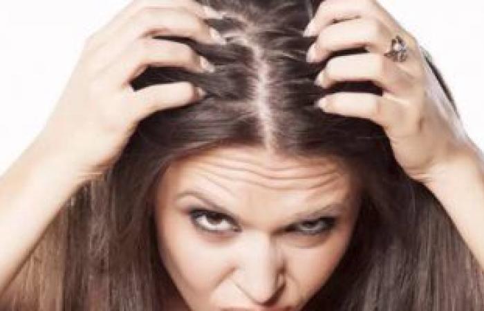 5 علاجات منزلية فعالة للقضاء على الشعر الأبيض