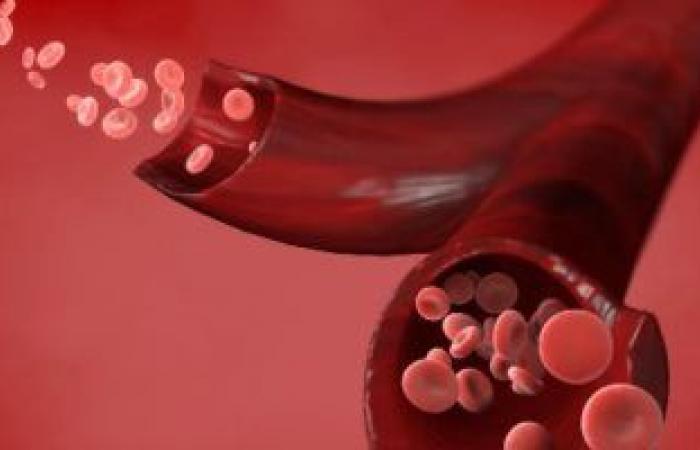 اختبار البيليروبين يكشف عن مستويات فقر الدم وسمية المخدرات
