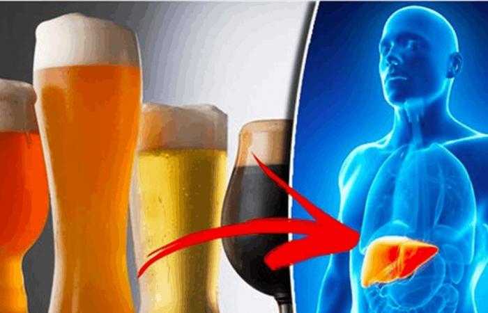 مرض الكبد الكحولي... اليكم بعض العوارض
