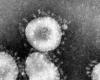 فيروس 'كورونا'.. شبيه بالأنفلونزا وسهل الإنتشار!