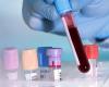 اختبار دم ثوري يكشف 50 نوعاً من السرطان!