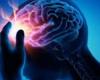 علماء ألمان: التحفيز العميق للمخ يمنع نوبات الصرع