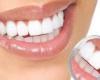 كيف تتخلص من البقع البنية بالأسنان بعلاجات منزلية؟ استخدم قشر الليمون