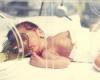 أسباب الالتهاب الرئوي الخلقي عند الأطفال حديثي الولادة