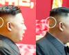 كدمة وضمادة.. رأس زعيم كوريا الشمالية يثير الحيرة!