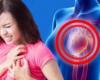 عوامل تزيد من خطر الإصابة بالسكتة القلبية أبرزها الخمول وارتفاع الضغط