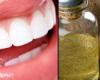 فوائد زيت جوز الهند.. يمنع تسوس الأسنان ويعالج التهاب اللثة