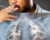 5 أشياء يجب معرفتها عن سرطان الرئة.. التدخين عامل الخطر الرئيسى