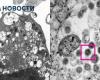 علماء هونج كونج ينشرون أول صورة لمتحور أوميكرون بالمجهر الإلكترونى