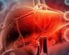 خبراء الصحة: الفيروس الغدي ما زال هو الاحتمال الأساسي للإصابة بالتهاب الكبد