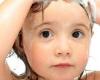 كيف تتخلصين من قشرة الشعر عند الأطفال