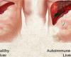 هل يمكن أن تصاب بالتهاب الكبد سي من نقطة دم أو جرح صغير؟