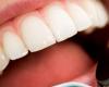 دواء يحفز إنبات أسنان جديدة.. إليكم التفاصيل!