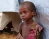 نداء أممي لإنقاذ 30 مليون طفل يعانون سوء تغذية حاداً