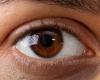 الهالات السوداء تحت العينين قد تشير الى اصابتكم ببعض الأمراض